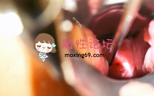 国产自拍《度盘》重口味《萌萌奶卉》刮毛 拳交 強製高潮 穿乳釘 鴨嘴擴陰器內窺合集《16.6g  300+pv》